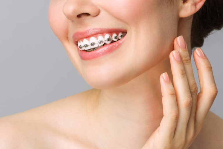 Orthodontic,Dental,Care,Concept.,Woman,Healthy,Smile,Close,Up.,Closeup
